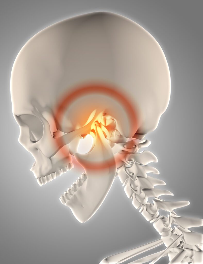 TMJ treatment in Madill and Ardmore, OK